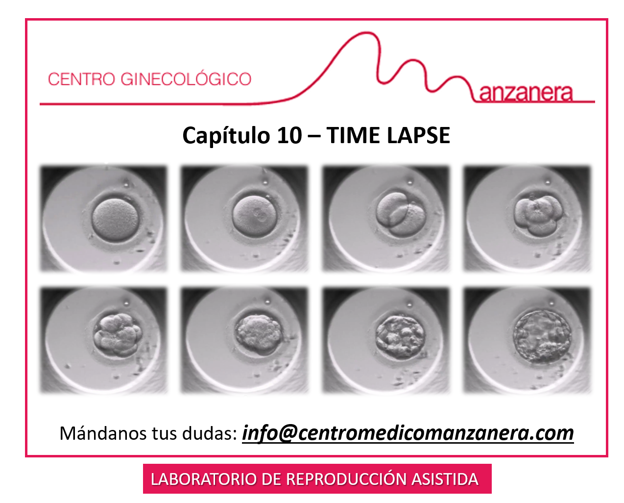 CAPITULO 10. TIME LAPSE EN LOS TRATAMIENTOS DE REPRODUCCION ASISTIDA (FIV)