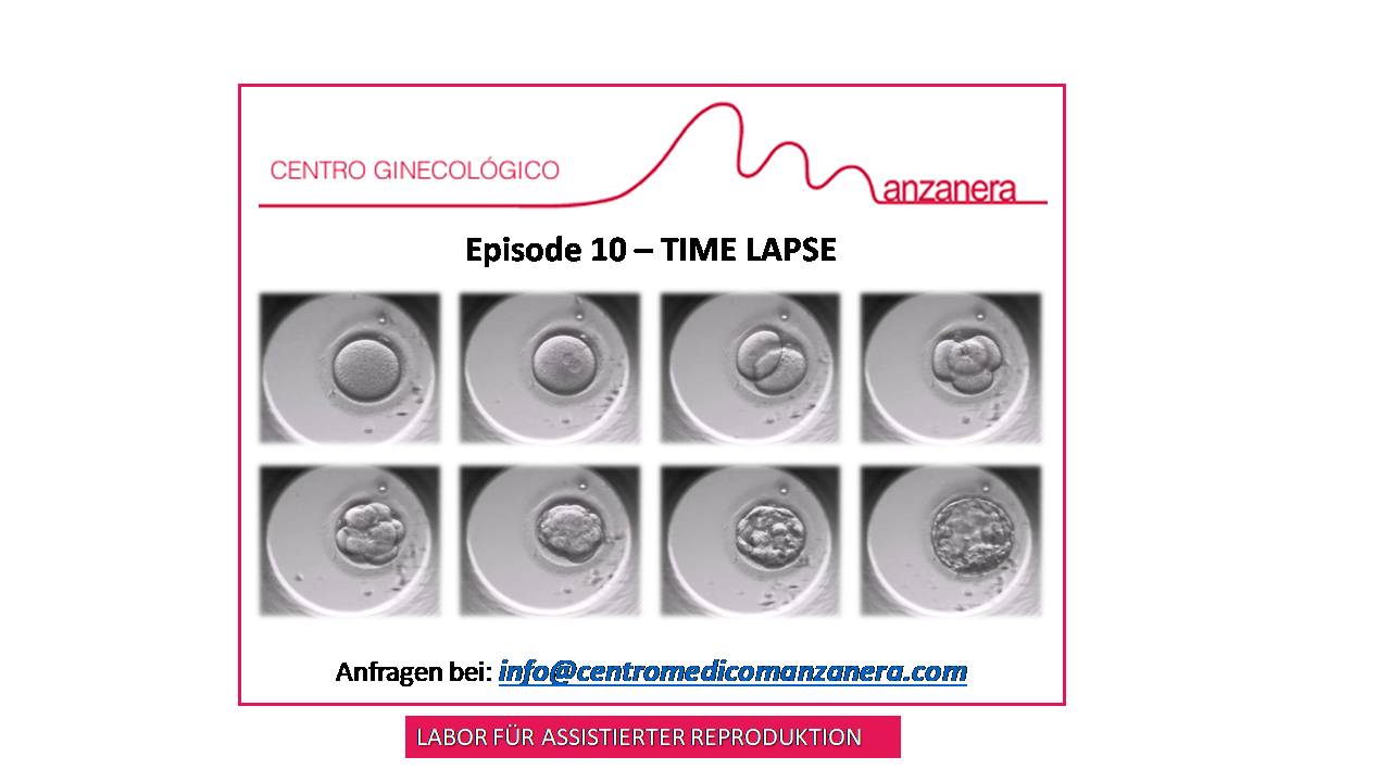 EPISODE  10. TIME-LAPSE BEI BEHANDLUNGEN DER ASSISTIERTEN REPRODUKTION (IVF)