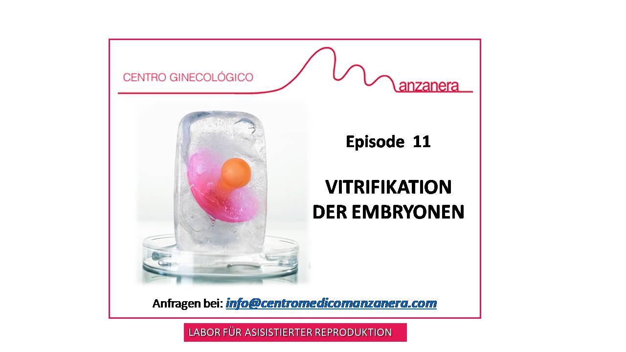 EPISODE 11. VITRIFIKATION  DER EMBRYONEN BEI FRUCHTBARKEITSBEHANDLUNGEN (IVF-ICSI)