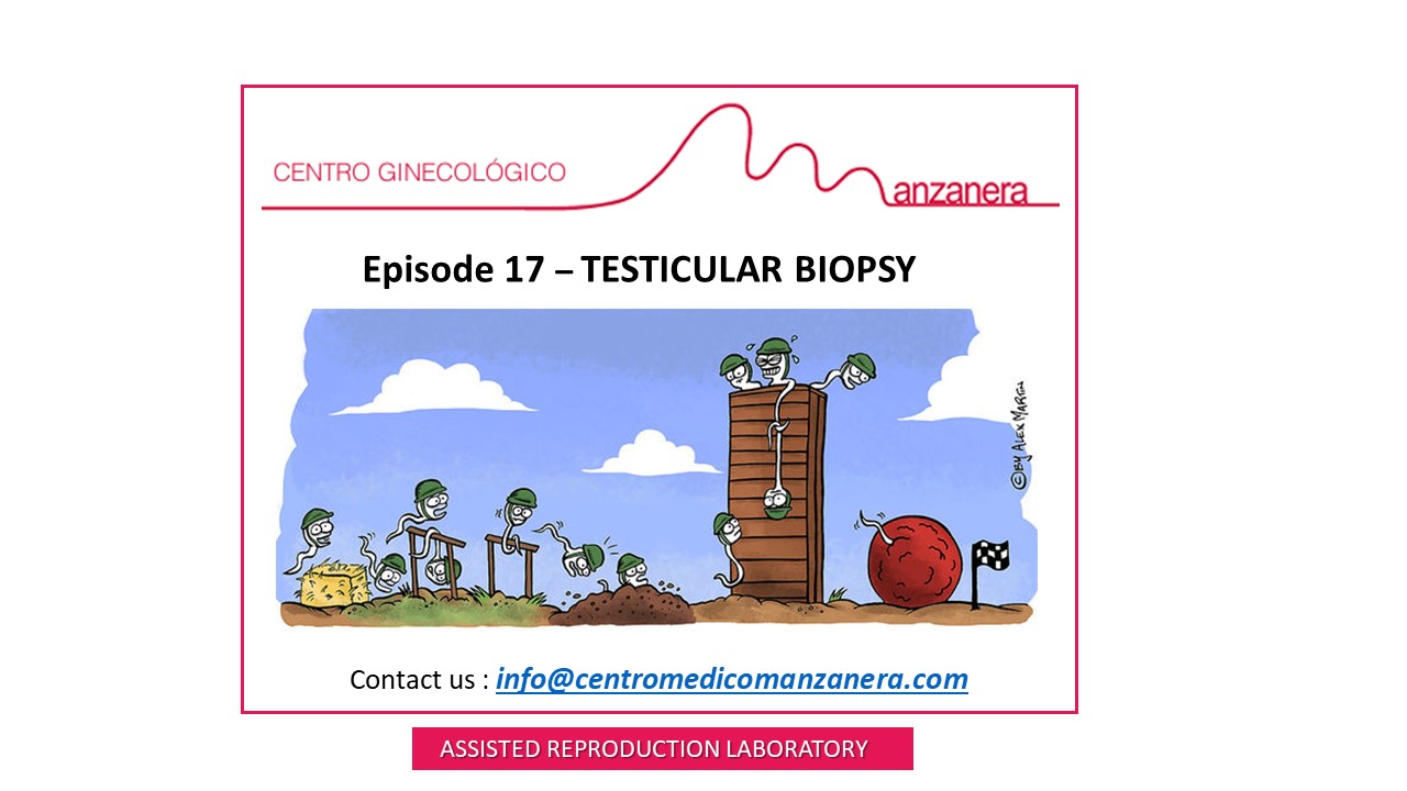 EPISODE 17. TESTICULAR BIOPSY IN FERTILITY TREATMENTS (IVF)