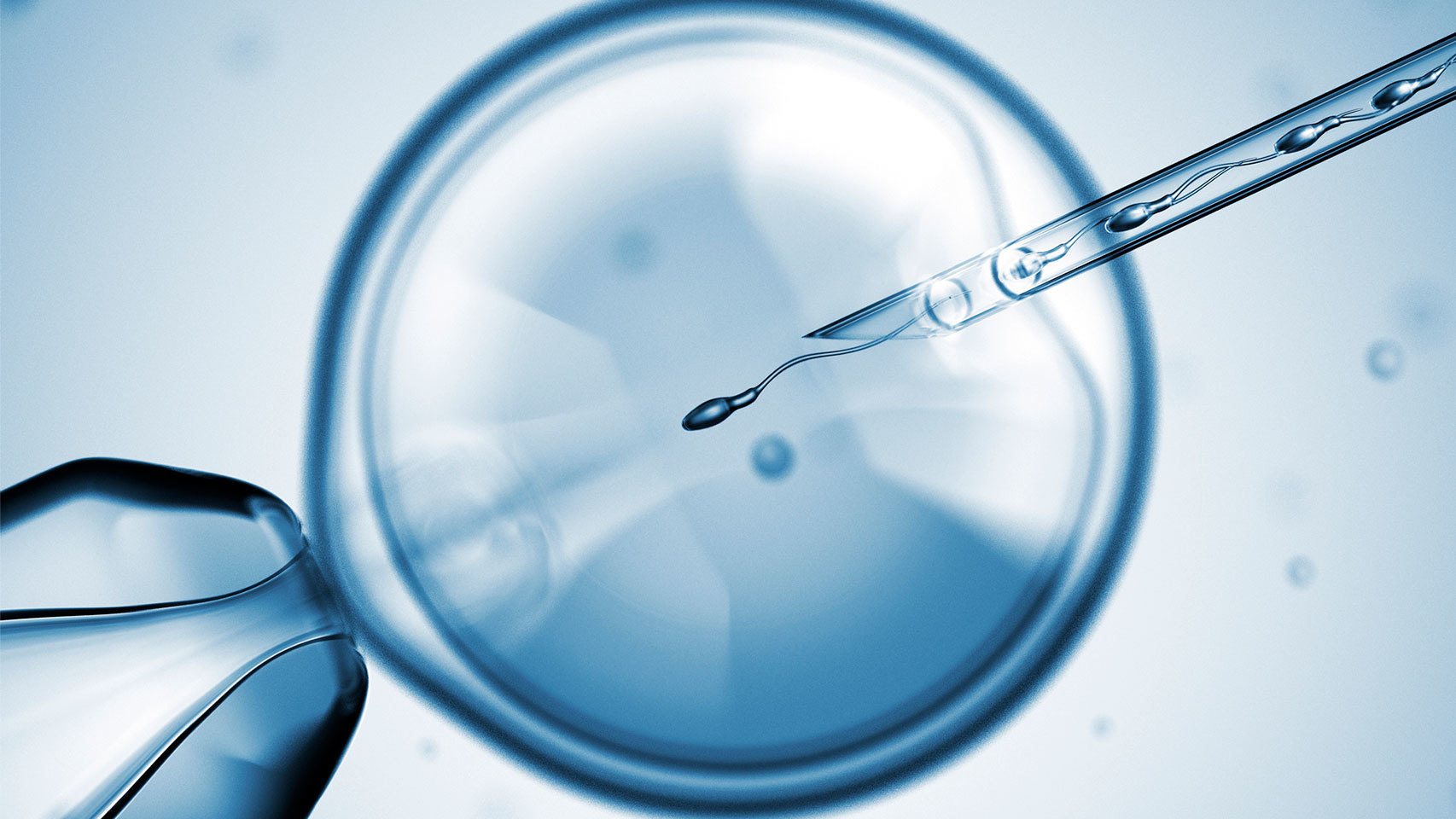 UPCOMING ADVANCES IN ASSISTED REPRODUCTION